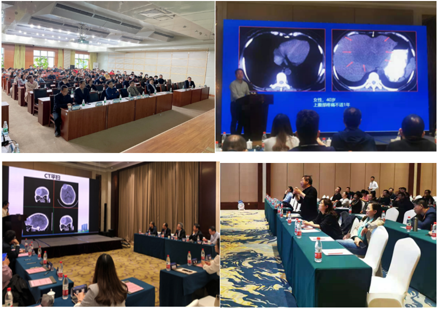 山东省医学会放射学分会“助力基层”工程暨“恒影相行基层大讲堂”3-5月培训班成功举办