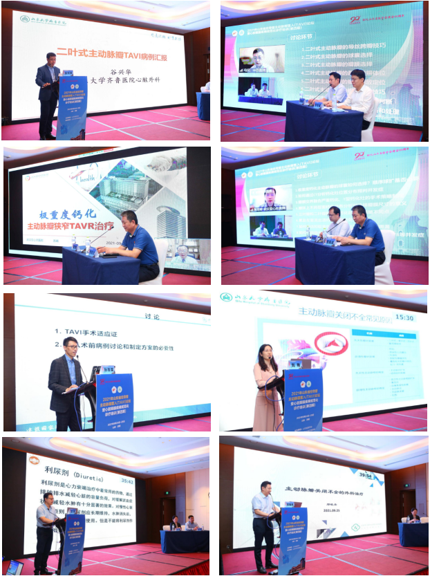 2021年山东省经导管主动脉瓣置入(TAVI)论坛暨心脏瓣膜疾病规范化诊疗培训(第四期)成功举办