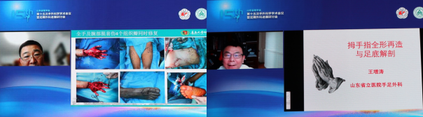 山东省医学会第十五次手外科学学术会议在济南成功召开