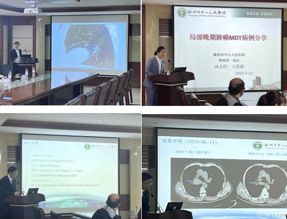 肺癌食管癌多学科联合委员会专家组到滕州市中心人民医院现场指导肺癌多学科规范化诊疗工作