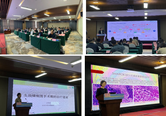 山东省医学会咽喉肿瘤多学科规范化诊疗巡讲－菏泽站成功举办