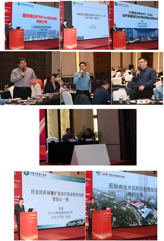 山东省医学会第二次胆石病微创诊疗