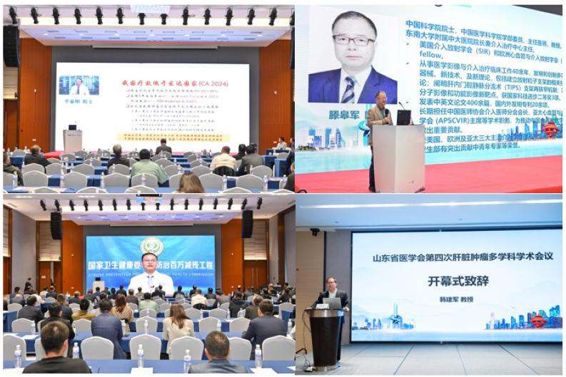 山东省医学会第四次肝脏肿瘤多学科学术会议在青岛召开